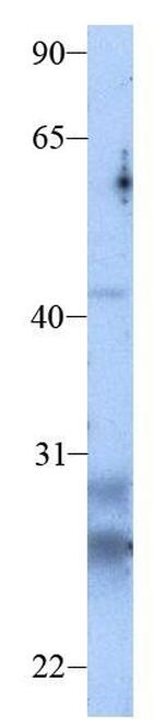 Claudin 13 Antibody in Western Blot (WB)