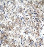 GTF2H1 Antibody in Immunohistochemistry (IHC)