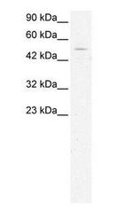 GTF2H1 Antibody in Western Blot (WB)