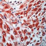 VEGF Receptor 3 Antibody in Immunohistochemistry (IHC)