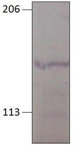 PGCD Antibody in Western Blot (WB)