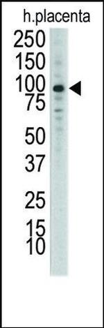 MCK10 Antibody in Western Blot (WB)