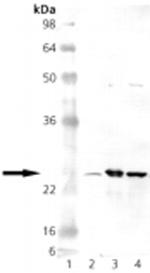 SOD2 Antibody in Western Blot (WB)