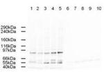 AP2 alpha Antibody in Western Blot (WB)