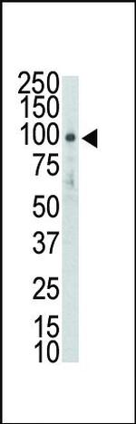 DDR2 Antibody in Western Blot (WB)