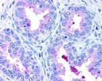 ABCA1 Antibody in Immunohistochemistry (Paraffin) (IHC (P))