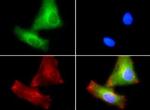 PLTP Antibody in Immunocytochemistry (ICC/IF)