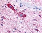 TSH Receptor Antibody in Immunohistochemistry (Paraffin) (IHC (P))