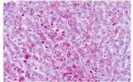 FZD6 Antibody in Immunohistochemistry (Paraffin) (IHC (P))