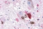 OR10R2 Antibody in Immunohistochemistry (Paraffin) (IHC (P))