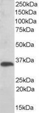 TMX Antibody in Western Blot (WB)