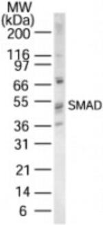 SMAD1/SMAD5/SMAD9 Antibody in Western Blot (WB)