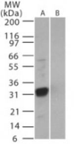 SARS Coronavirus 3b Antibody in Western Blot (WB)