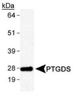 PTGDS Antibody in Western Blot (WB)