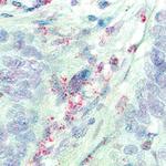 FOXP3 Antibody in Immunohistochemistry (Paraffin) (IHC (P))