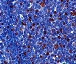 FOXP3 Antibody in Immunohistochemistry (Paraffin) (IHC (P))