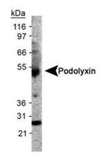 PODXL Antibody in Western Blot (WB)