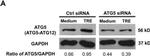 ATG5 Antibody in Western Blot (WB)