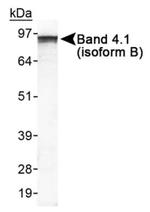 EPB41L3 Antibody in Western Blot (WB)