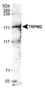 TRPM2 Antibody in Western Blot (WB)