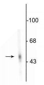 DOPA Decarboxylase Antibody in Western Blot (WB)