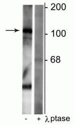 Phospho-GABBR1 (Ser923) Antibody in Western Blot (WB)