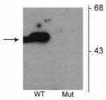 Phospho-Parkin (Ser101) Antibody in Western Blot (WB)