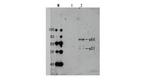 HIV1 Reverse Transcriptase Antibody in Western Blot (WB)