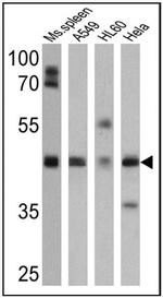 BACE2 Antibody in Western Blot (WB)