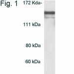 HDAC4 Antibody in Western Blot (WB)