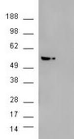 AKT3 Antibody in Western Blot (WB)