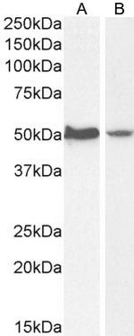 AKT3 Antibody in Western Blot (WB)