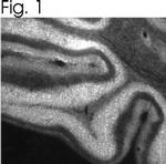 IP3 Receptor 2 Antibody in Immunohistochemistry (IHC)