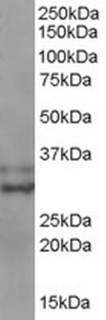 Livin Antibody in Western Blot (WB)