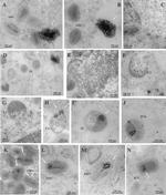 Cyclophilin A Antibody in Immunomicroscopy (IM)