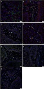 SOX2 Antibody in Immunohistochemistry (Paraffin) (IHC (P))