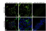 NEFM Antibody in Immunocytochemistry (ICC/IF)