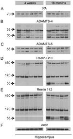 ADAMTS4 Antibody in Western Blot (WB)