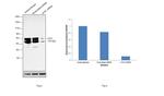 alpha-1 Antitrypsin Antibody