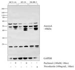 Aurora A Antibody in Western Blot (WB)