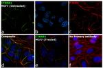 beta Catenin Antibody in Immunocytochemistry (ICC/IF)