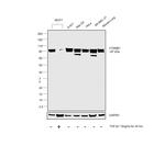 beta Catenin Antibody in Western Blot (WB)