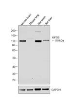 Kinesin 5B Antibody in Western Blot (WB)