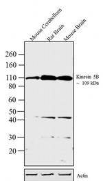 Kinesin 5B Antibody in Western Blot (WB)