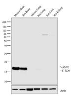 VAMP2 Antibody