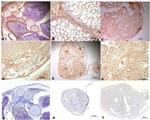 FOXL2 Antibody in Immunohistochemistry (Paraffin) (IHC (P))