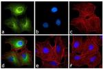 Rat IgG2a Secondary Antibody in Immunocytochemistry (ICC/IF)