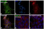 TRAIL-R2 (DR5) Antibody