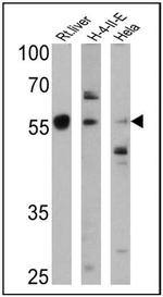 Cyp4a10 Antibody in Western Blot (WB)