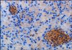 SSTR2 Antibody in Immunohistochemistry (Paraffin) (IHC (P))